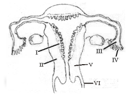 The Figure Given Below Depicts A Diagrammatic Sectional